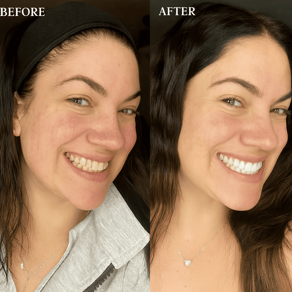 Teeth Whitening Strips - smilepure