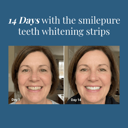 Teeth Whitening Strips